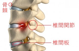 椎間関節